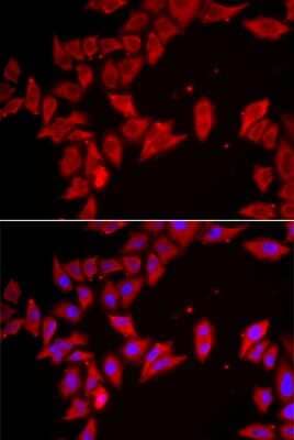 Immunocytochemistry/ Immunofluorescence: UGT Antibody - BSA Free [NBP2-93330]