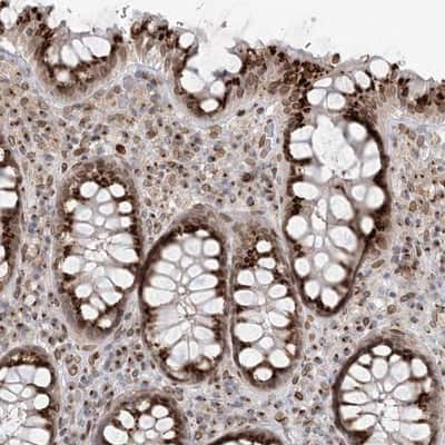 Immunohistochemistry-Paraffin: UGT Antibody [NBP1-80642]