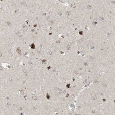 Immunohistochemistry-Paraffin: UGT Antibody [NBP1-80642]