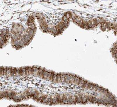 Immunohistochemistry-Paraffin: UGT Antibody [NBP1-80642]