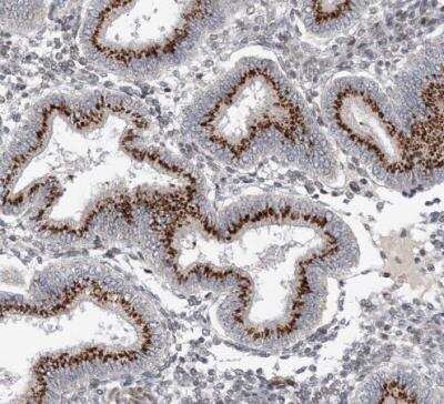 Immunohistochemistry-Paraffin: UGT Antibody [NBP1-80642]