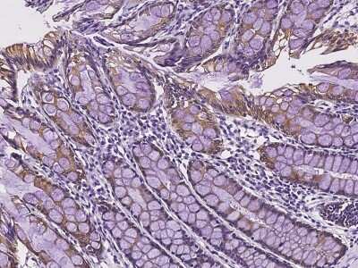 Immunohistochemistry-Paraffin: UGT Antibody [NBP2-98137]