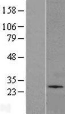 Western Blot: UGT Overexpression Lysate [NBL1-16116]