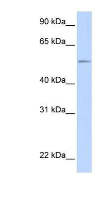 Western Blot: Glucuronosyltransferase 1A1/UGT1A1 Antibody [NBP1-62431]