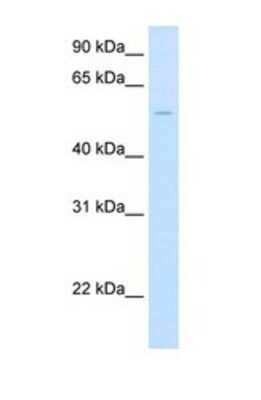 Western Blot: Glucuronosyltransferase 1A1/UGT1A1 Antibody [NBP1-69448]