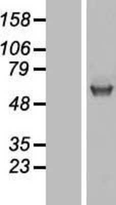 Western Blot: Glucuronosyltransferase 1A1/UGT1A1 Overexpression Lysate [NBP2-09025]