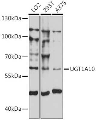 Western Blot: UGT1A10 AntibodyAzide and BSA Free [NBP2-94621]