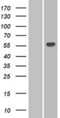 Western Blot: UGT1A3 Overexpression Lysate [NBP2-06720]