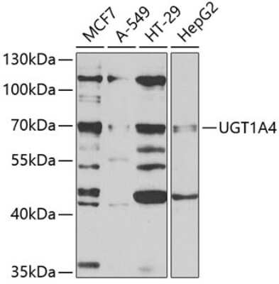 Western Blot: UGT1A4 AntibodyBSA Free [NBP2-94258]