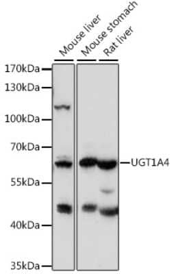 Western Blot: UGT1A4 AntibodyAzide and BSA Free [NBP2-94266]