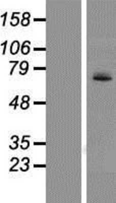 Western Blot: UGT1A4 Overexpression Lysate [NBP2-07528]