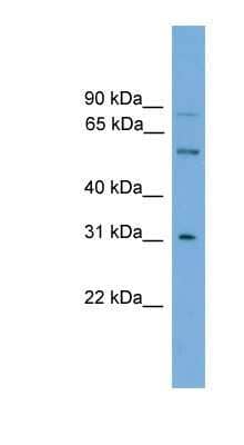 Western Blot: UGT1A5 Antibody [NBP1-91336]