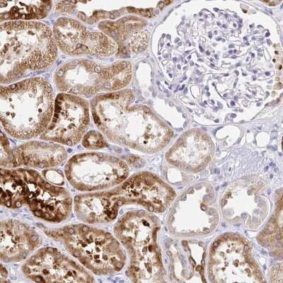 Immunohistochemistry: UGT1A6 Antibody [NBP2-49113]