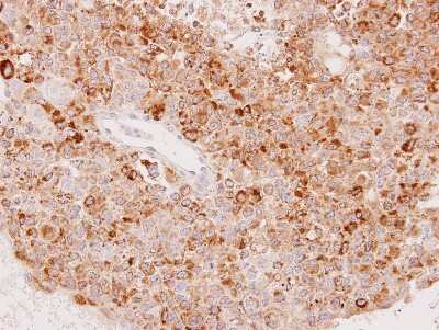 Immunohistochemistry-Paraffin: UGT1A6 Antibody [NBP1-33743]
