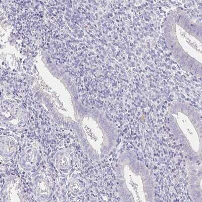 Immunohistochemistry-Paraffin: UGT1A6 Antibody [NBP2-49113]