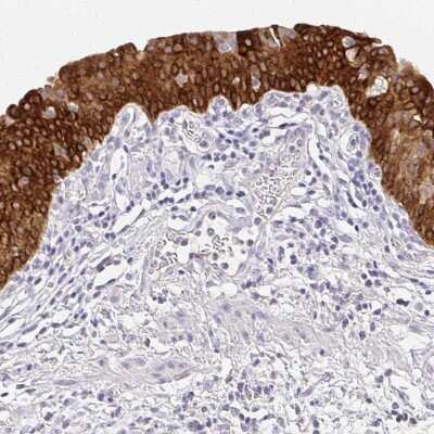 Immunohistochemistry-Paraffin: UGT1A6 Antibody [NBP2-49113]