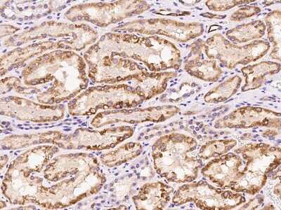 Immunohistochemistry-Paraffin: UGT1A6 Antibody [NBP2-97897]