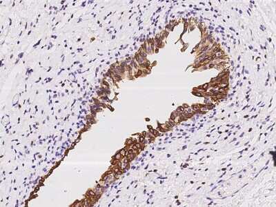 Immunohistochemistry-Paraffin: UGT1A6 Antibody [NBP2-97897]