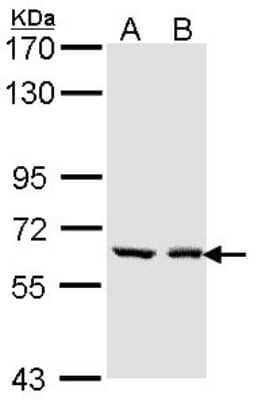 Western Blot: UGT1A6 Antibody [NBP1-33743]