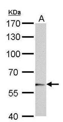 Western Blot: UGT1A6 Antibody [NBP1-33743]