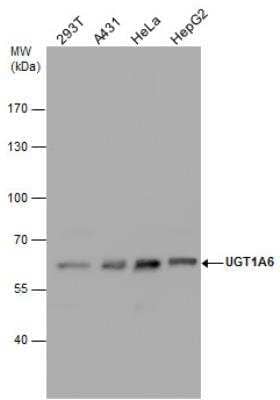 Western Blot: UGT1A6 Antibody [NBP1-33743]