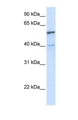 Western Blot: UGT1A6 Antibody [NBP1-69707]