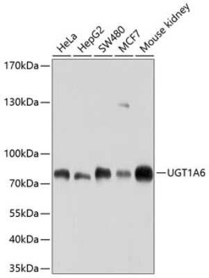 Western Blot: UGT1A6 AntibodyBSA Free [NBP2-94532]