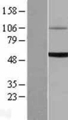 Western Blot: UGT1A6 Overexpression Lysate [NBL1-17598]