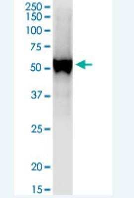 Western Blot: UGT1A7 Antibody [H00054577-B01P-50ug]