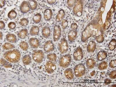 Immunohistochemistry-Paraffin: UGT1A9 Antibody [H00054600-B01P]