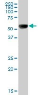 Western Blot: UGT1A9 Antibody [H00054600-B01P]