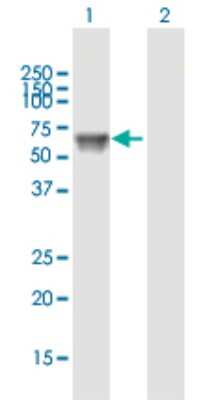 Western Blot: UGT1A9 Antibody [H00054600-B01P]