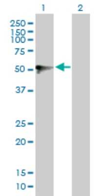 Western Blot: UGT1A9 Antibody [H00054600-D01P]