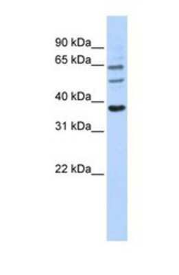 Western Blot: UGT1A9 Antibody [NBP1-69689]