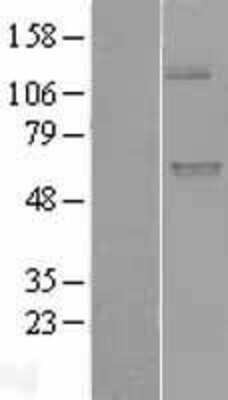 Western Blot: UGT1A9 Overexpression Lysate [NBL1-17600]