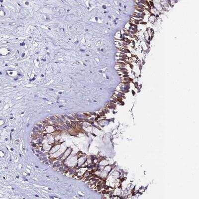 Immunohistochemistry-Paraffin: UGT2A1 Antibody [NBP1-94148]