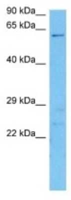 Western Blot: UGT2A2 Antibody [NBP3-10164]