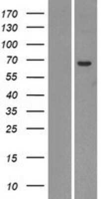 Western Blot: UGT2A1 Overexpression Lysate [NBP2-07581]