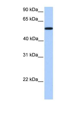 Western Blot: UGT2A3 Antibody [NBP1-62332]