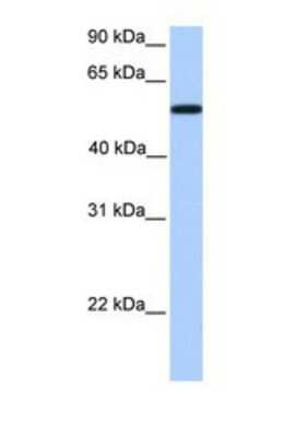 Western Blot: UGT2A3 Antibody [NBP1-69358]