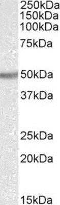 Western Blot: UGT2B Antibody [NBP1-72063]