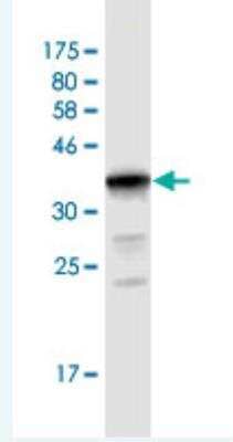 Western Blot: UGT2B10 Antibody (1B5) [H00007365-M02]