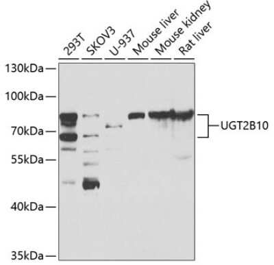 Western Blot: UGT2B10 AntibodyBSA Free [NBP2-93266]