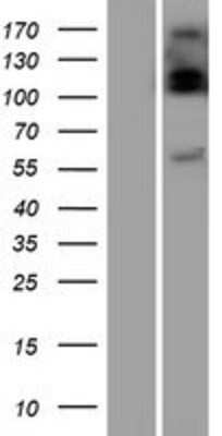 Western Blot: UGT2B10 Overexpression Lysate [NBP2-08443]