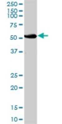 Western Blot: UGT2B15 Antibody [H00007366-B01P]