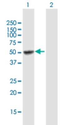 Western Blot: UGT2B15 Antibody [H00007366-B01P]