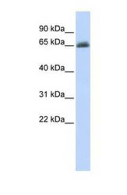 Western Blot: UGT2B15 Antibody [NBP1-69700]