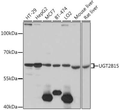 Western Blot: UGT2B15 AntibodyAzide and BSA Free [NBP2-94747]