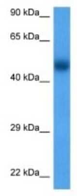 Western Blot: UGT2B17 Antibody [NBP3-09985]