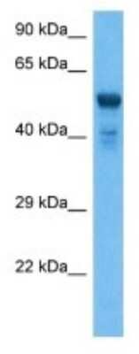 Western Blot: UGT2B28 Antibody [NBP3-10997]